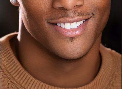 Smile Makeover